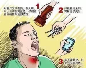  「周师傅」老板爱吃鱼，吞下小鱼刺，巧用“土办法”差点要老命