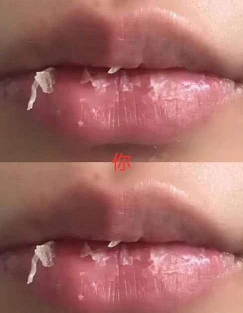  嘴唇|同样是“嘴唇特写”，别人VS你，一个美若天仙，一个像夜叉巡街
