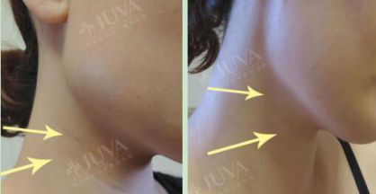 只养不治何来天鹅颈 欧华ballet颈秀系列受推崇