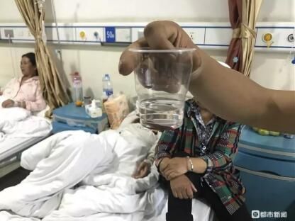  「张秋芬」贵州7岁男孩反复流鼻血，到医院一查，鼻腔内竟取出这