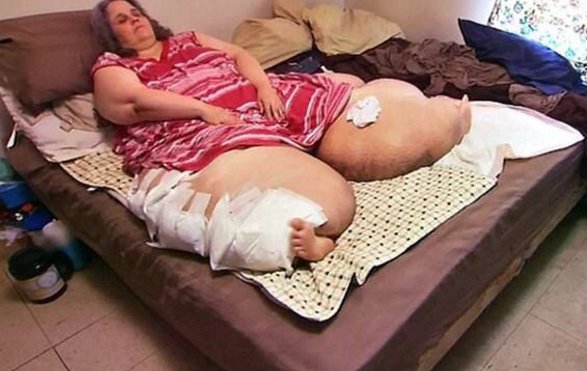 她重达550斤，光腿就重约400斤，每生一个孩子重100斤