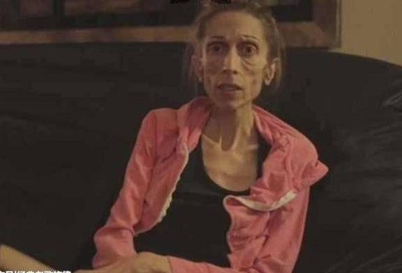 国外一女子从120斤瘦到了30斤，真的是瘦成了一道闪电