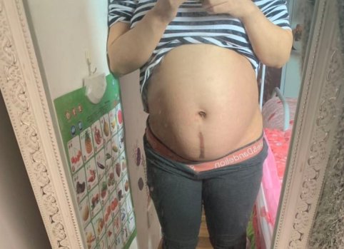  [活跃]孕妇不听劝，四维彩超不做任何准备，被要求爬楼梯