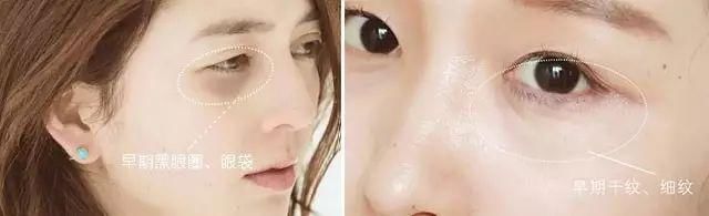 每天抹点它，活到五十没眼纹，没眼袋，神了！