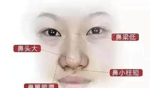 『手术』鼻综合究竟是什么样的手术?进来了解一下吧