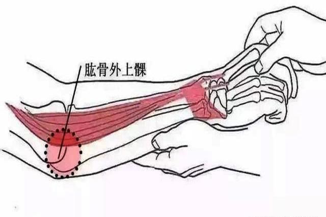  「找上门」钓鱼时间久了，这4种病会“找上门”
