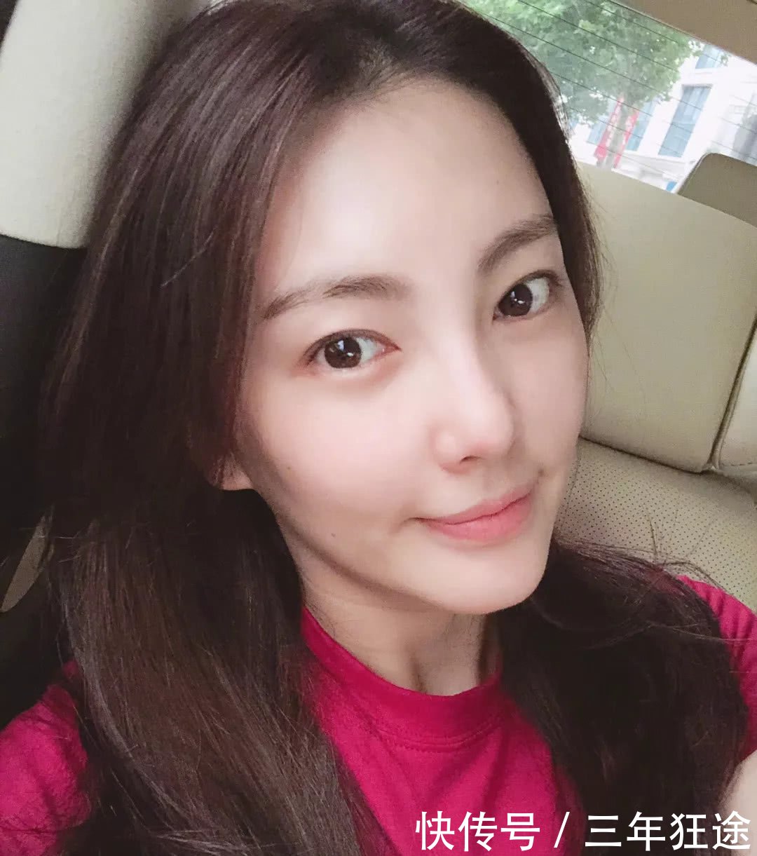 90后郑爽的黑眼圈比周迅都严重？眼部保养要重视了！