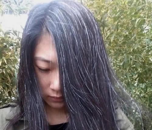  #关系#白头发突然变黑,也未必是好事!这可能和哪些原因有关系呢?