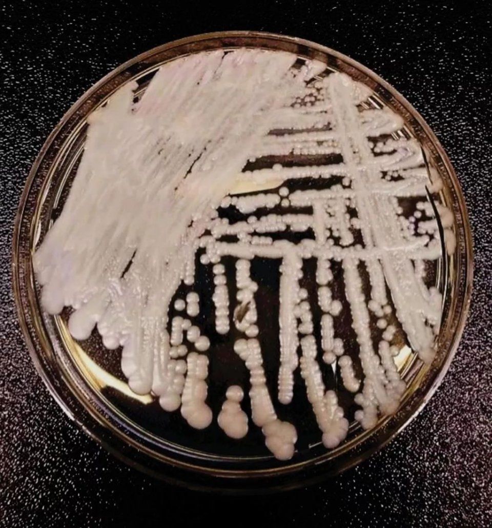 超级真菌被美国列为紧急威胁,中国已有18例