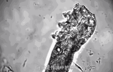 轻轻一刷，螨虫、痘痘黑头去无踪，还你光滑透亮好皮肤!