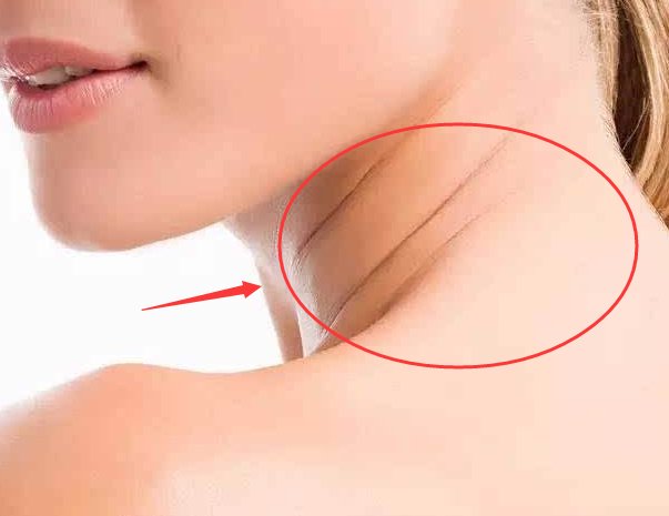 女人脸上最显老的4道皱纹，长全就变老奶奶了，学下面女人这样做