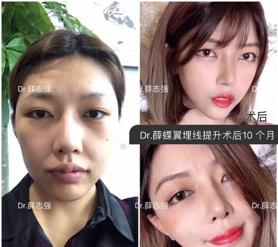 『后12小时内』假期术后注意事项大全!
