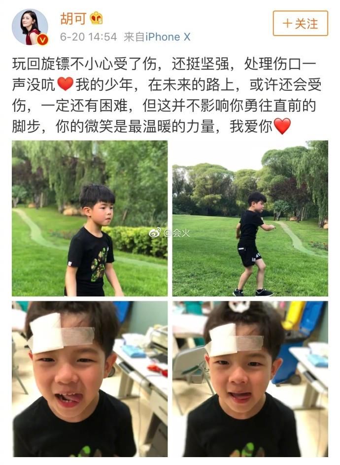 胡可曝安吉受伤，岳云鹏方回应侵权事件：和我们没有关系