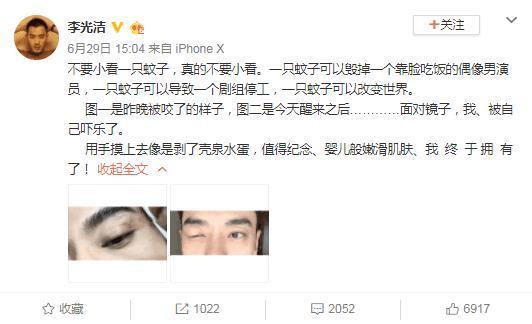 男星因被蚊子咬到致剧组停工，被骂耍大牌，网友：位置太尴尬！