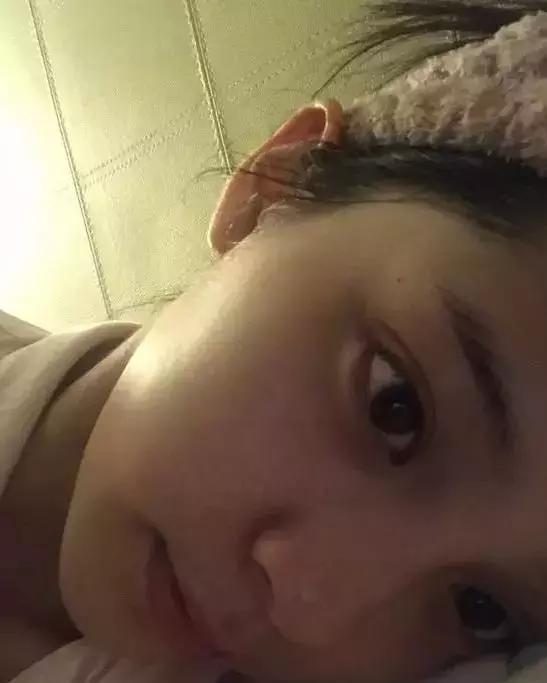 血管型黑眼圈@当妈后黑眼圈明显加重?黑眼圈不是病,挂在眼睛上真“要命”