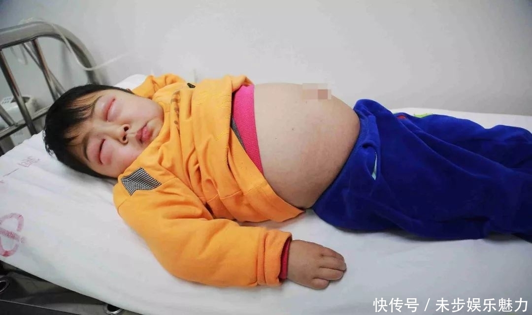 男童患怪病病好时帅帅的,发病时肚大像怀孕双