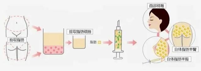 『凹陷』太阳穴凹陷、苹果肌干瘪、额头扁平？可以试试这个！