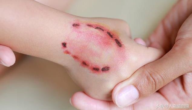 假疫苗害人不浅，为什么假货总是没法断绝？