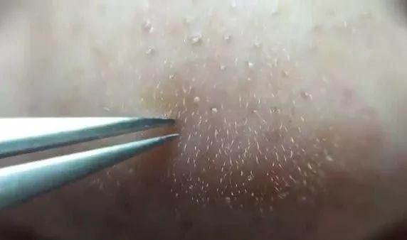 拔出黑头粉刺，地毯式清洁肌肤，还能缩小毛孔!素颜也自带妆容