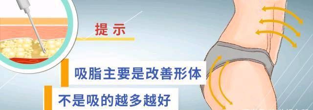  不在乎你吸@科普：抽脂时，哪些部位可以抽脂？有什么特别需要注意的吗？