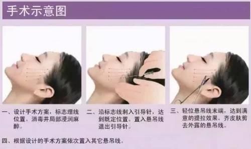  「恢复」30＋女生皮肤变松垮，怎样才能恢复到18岁的紧致脸？