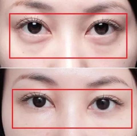  「中年」建议中年女人：脸上有纹不要慌！每天坚持这2步，祛皱嫩肤超管用