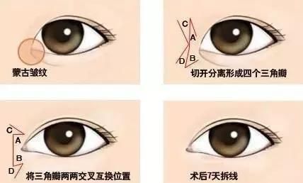 长那么好看？绝对整容了！双眼皮那么宽？是割的吧！