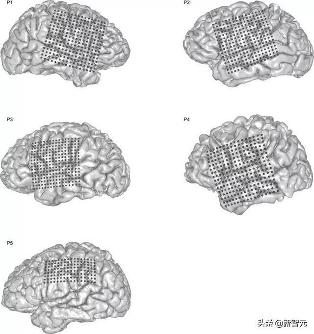 Nature重磅：华裔科学家成功解码脑电波，AI直接从大脑中合成语音