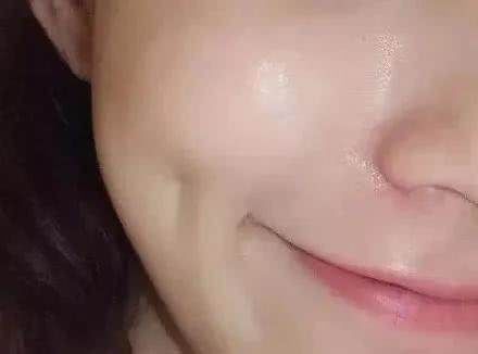  「医生」一次水光针＝1000张面膜？哪些情况不能打？