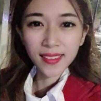 大眼睛美女做了双眼皮，男友说：恢复的挺不错的，越来越好看了