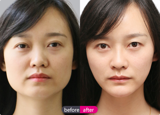 专访欧剑涛教授--整形心理学探索者