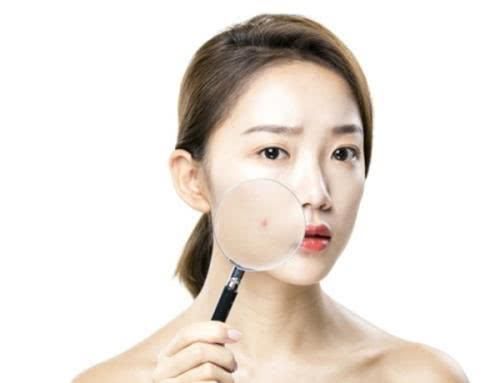 脸上有没有螨虫？抓住这4个信号后，来用3招把螨虫“连根拔起”