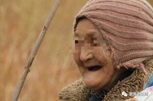 “整牙到底能不能瘦脸”终于有了权威结论，杨幂竟是被冤枉的?