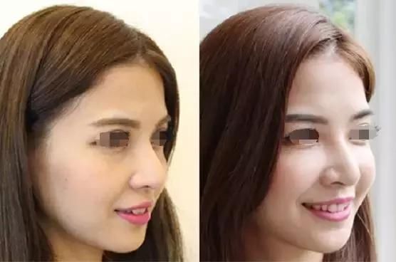 这是目前最流行的斩男脸TOP3，来看看自己属于哪种脸型