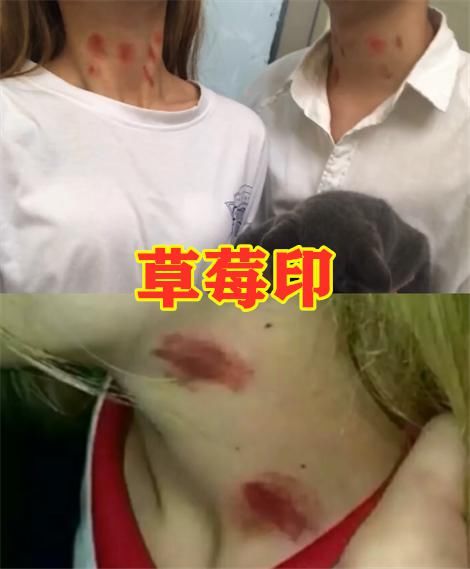 全网■全网都在“炫锁骨”?放硬币VS开瓶盖,看到草莓印:单身狗哭了!