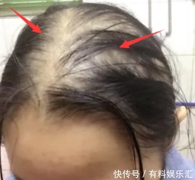  女生@被拉进“黑名单”的洗发水，00后女生仍在用难怪头发“大把掉”！