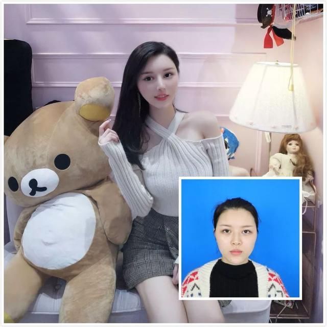 隆鼻后，竟让她成为了羡煞旁人的“明星脸”！