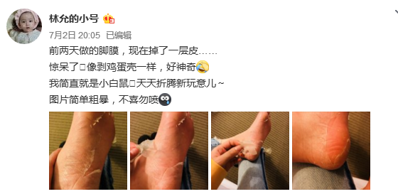 林允撕脚皮被怼 去角质这么做才好使
