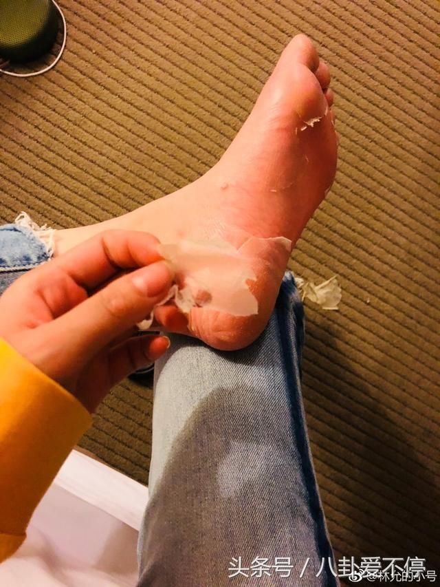 林允撕脚照片发网上，恶心还不让说，公开怼网友！学郑爽放飞自我