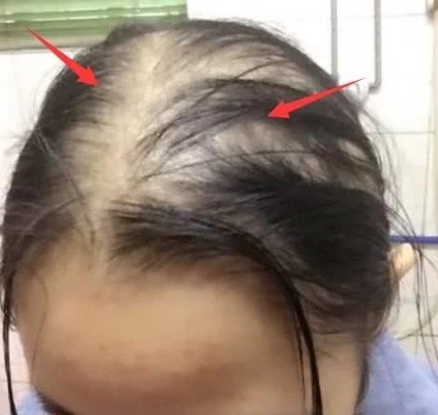  [悄悄]女生洗完头后，坚持做到这“3点”，头发悄悄顺滑，发量也变多了！