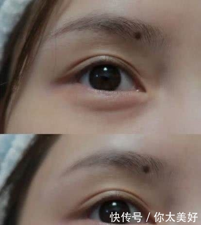 『女生』20岁的女生适合用啥眼霜?牛油果滋润,理肤泉含维C,你都用哪个