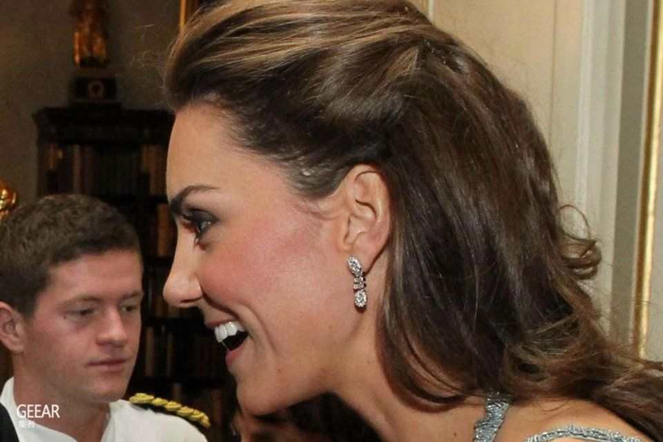 凯特王妃脸上这道疤痕你是否从未发现过?背后可是有段故事!