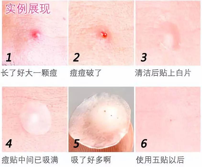 什么切乳房,烤肉,脂肪瘤,女明星写才是谣言重地