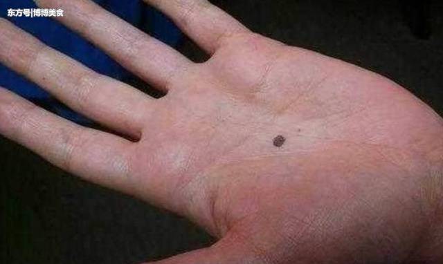 不论男女，手上没有这个东西，恭喜你癌细胞离你还很远