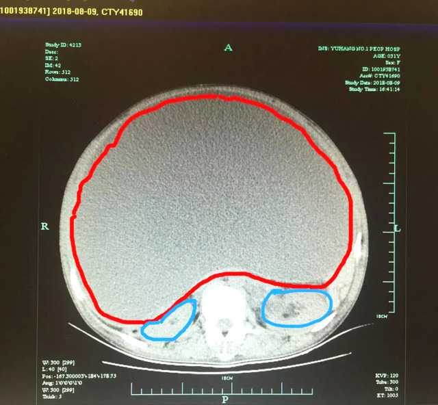 何洁深夜发文疑证实离婚，结婚三年舍不得买包买鞋，老公却在背后