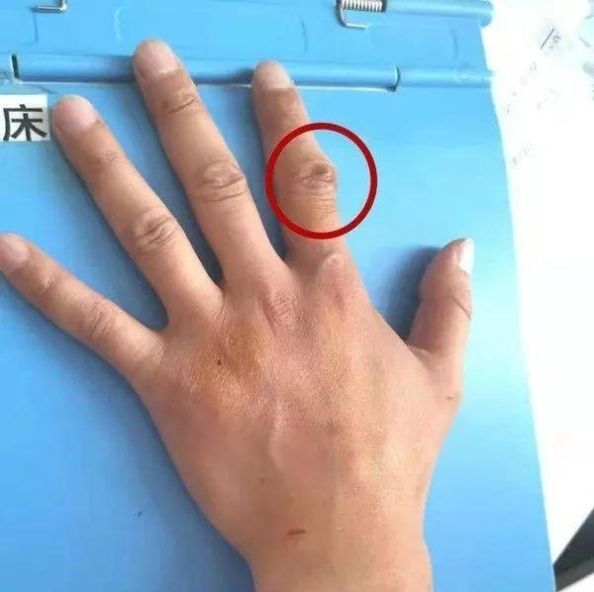  救援：救助坠崖驴友后失联，深圳两救援队员已不幸牺牲 | 新闻早