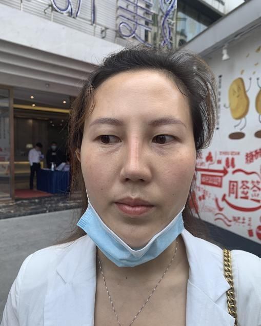  [隆鼻手术]俩女子隆鼻一个呼吸不畅一个假体顶出来！美容医院：类似的挺多…