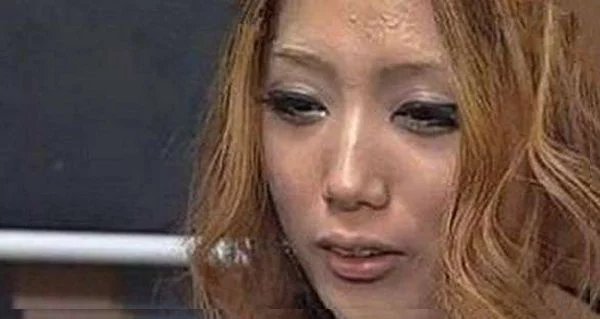 女子卸妆嫌麻烦，懒到两年不卸妆，医生帮她卸妆后直接吓懵了