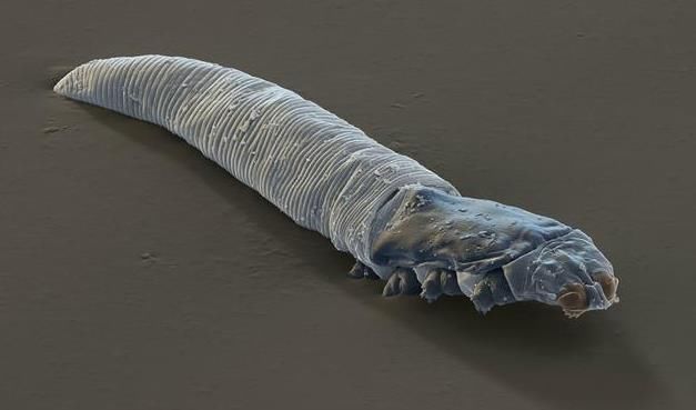 螨虫折腾你的脸有4个损害，不除螨，再多护肤品都是在喂养螨虫