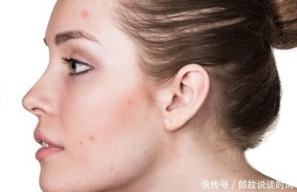 螨虫折腾你脸，4个损害的会出现，采用2招清走它！!